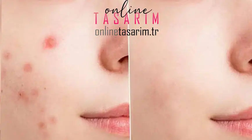 Online Fotoğraf Resim temizleme